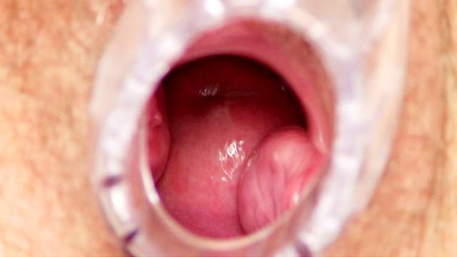 Mature nurse takes speculum in hairy hole
