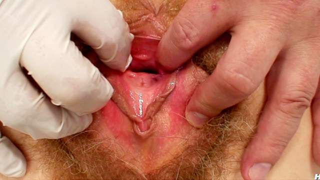 Medical exam for hairy mature chick